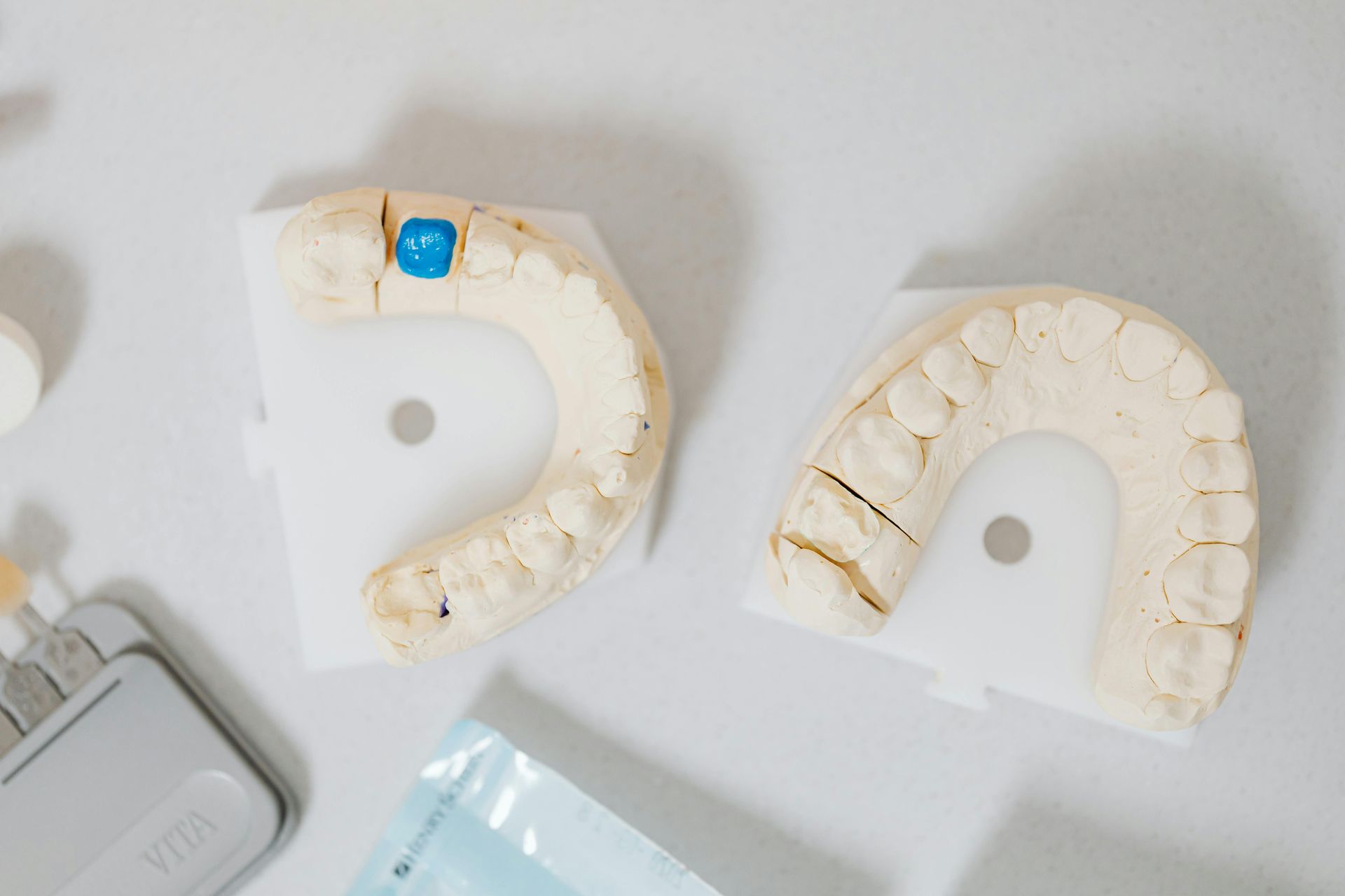 Dental molds of upper and lower teeth, on white cards, near dental tools.