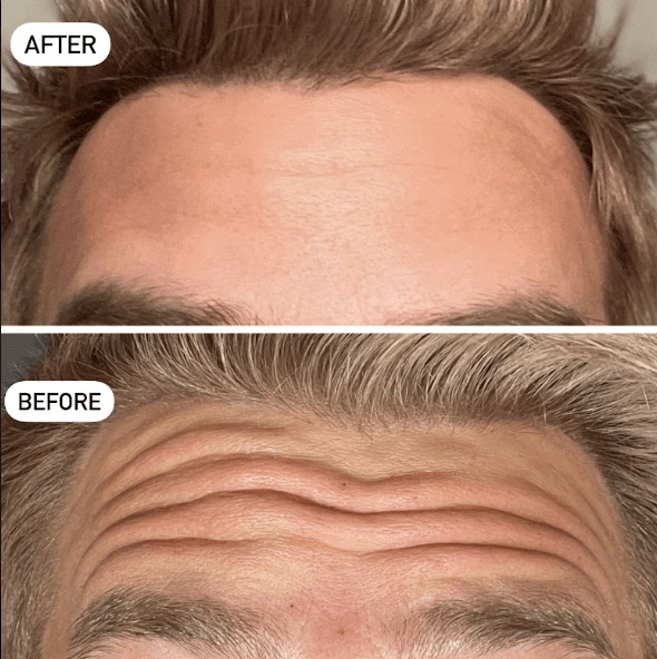 Before and after shot of client