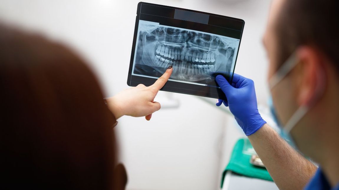radiografie dentali