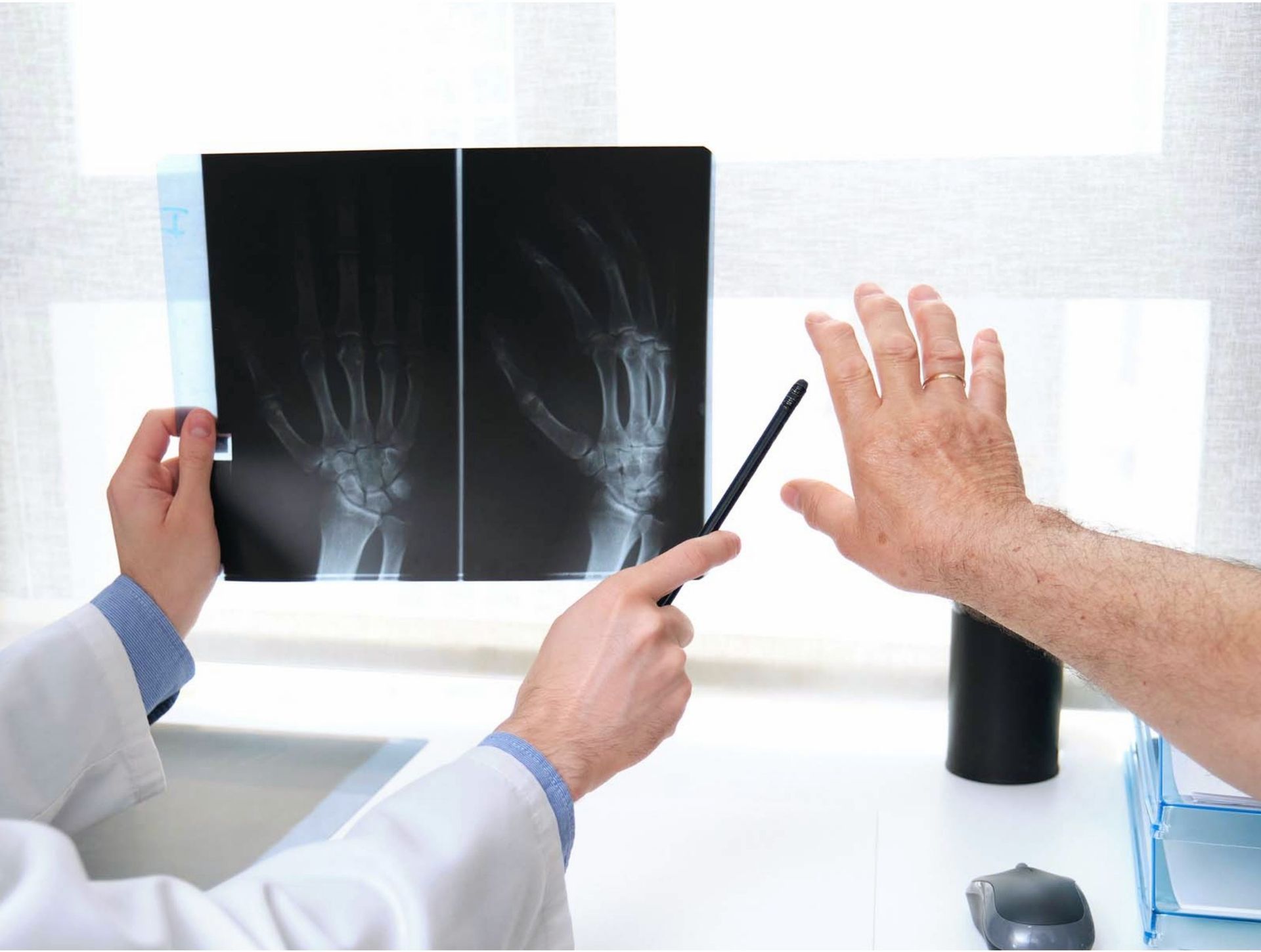 X-ray hands, one healthy, one with red inflamed joints highlighting arthritis.