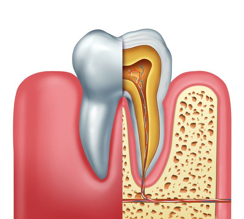 Root Canal — Turvey Park, NSW — Bright Smiles
