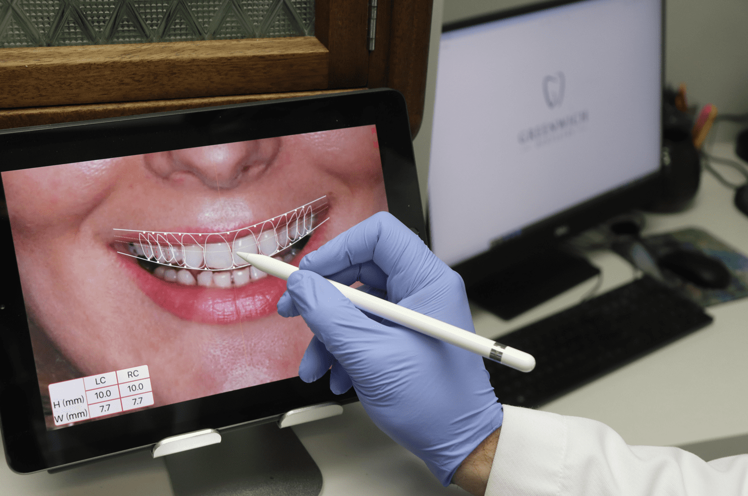 A person is holding a pen in front of a tablet with a picture of a woman's smile on it