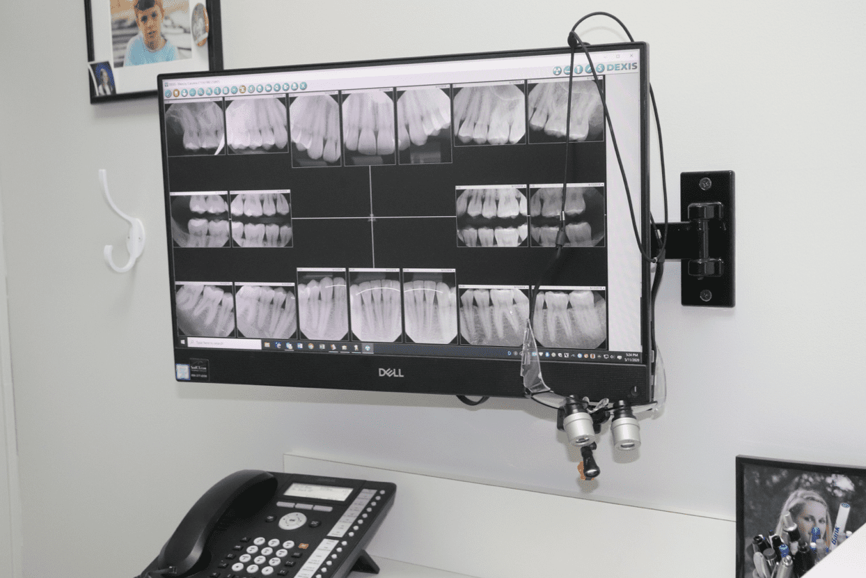An x-ray of a person 's teeth is displayed on a dell monitor