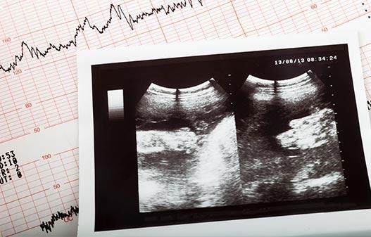 Consulta de cardiología