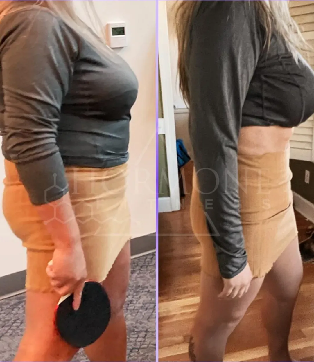 A weight loss before and after photo of a Hormone Fitness patient.