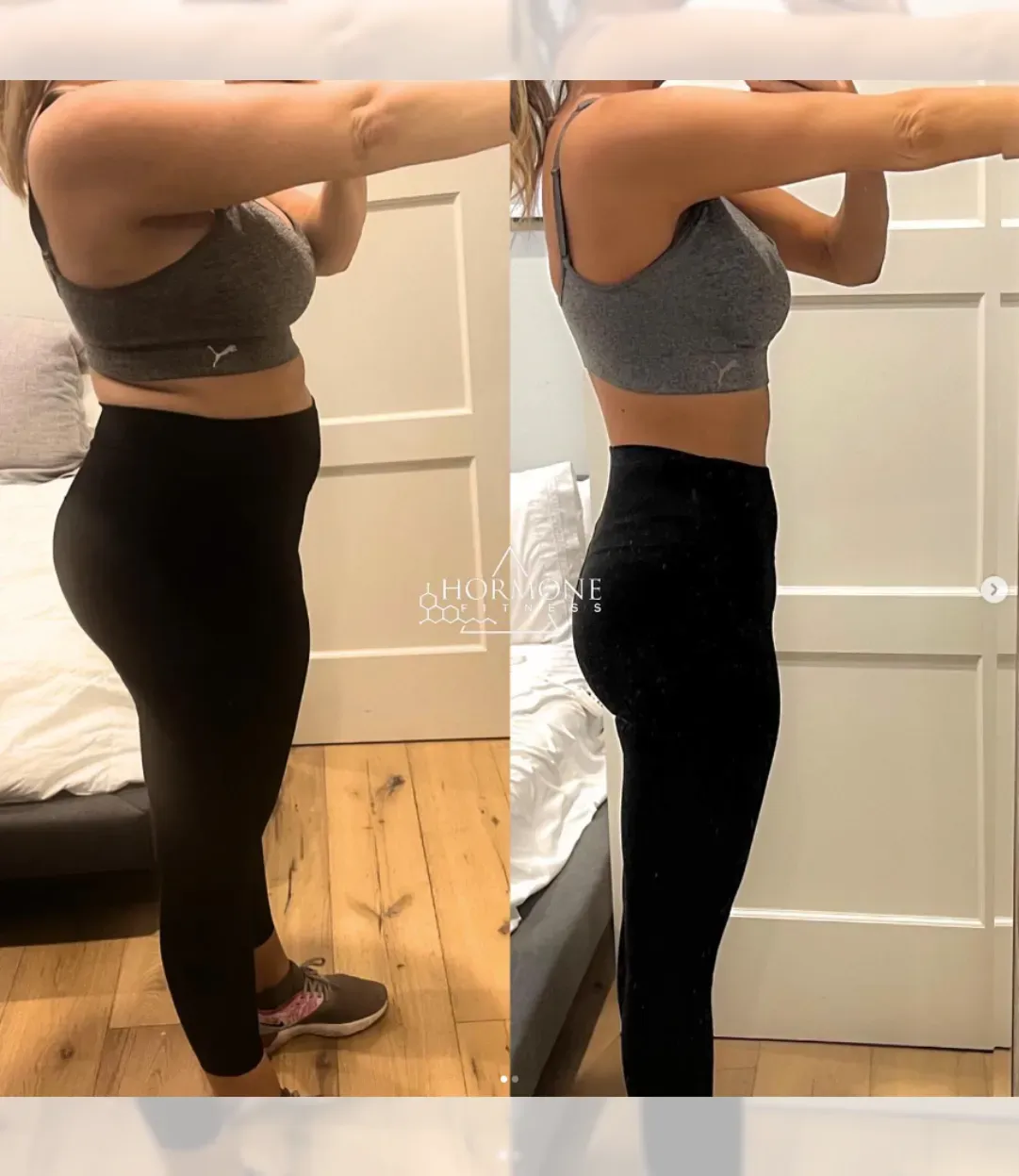 A before and after weight loss transformation from a side angle of a woman 's lower body 