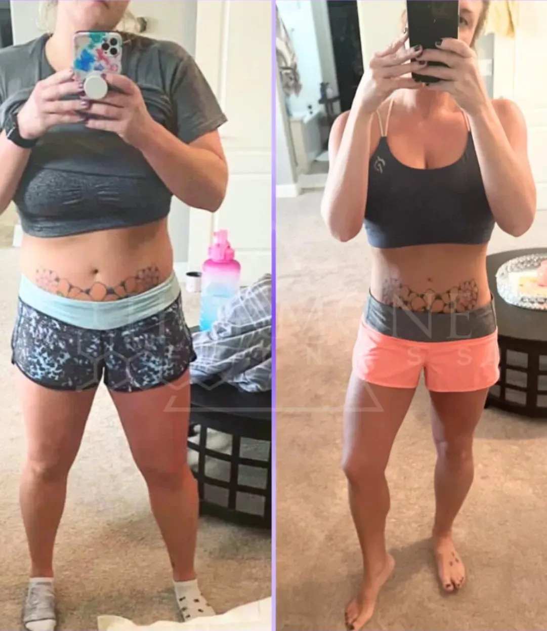 A before and after weight loss transformation of a white woman's waist who has lost weight