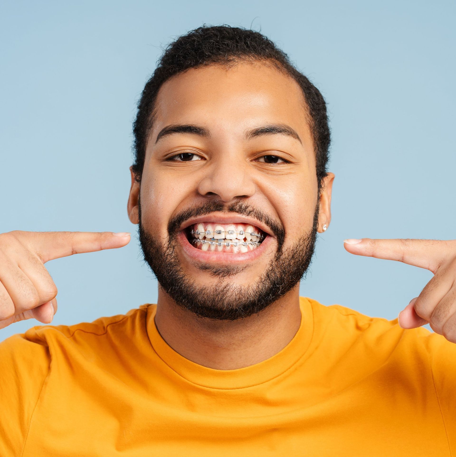 A man with braces on his teeth is smiling and pointing at his teeth.