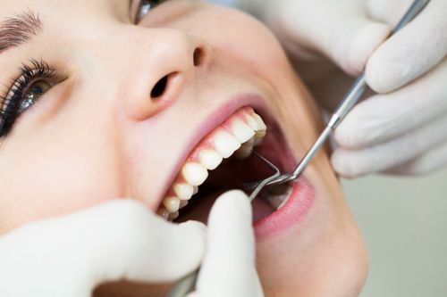 Dentista usa specillo e specchietto nella bocca di una paziente