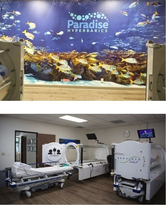 Oxygen Therapy — Hyperbaric Chamber in Temecula, CA