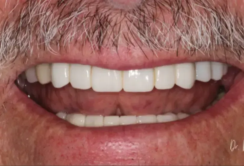 Straight, even teeth