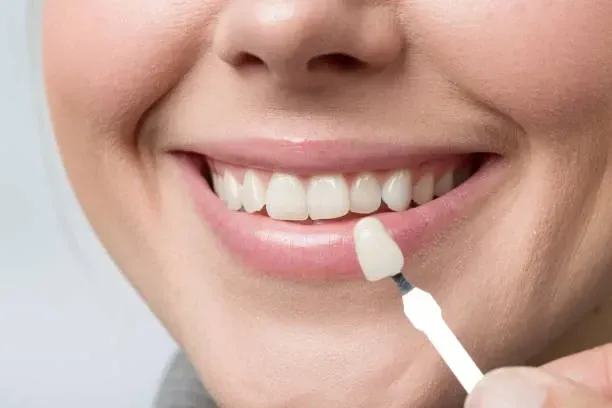 A close up of a woman 's teeth with a tooth shade in her mouth.