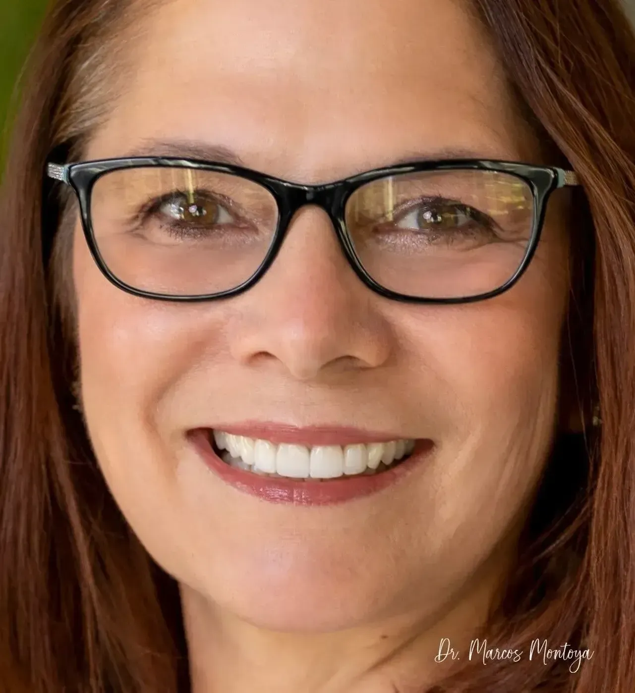 After picture of a woman with white teeth