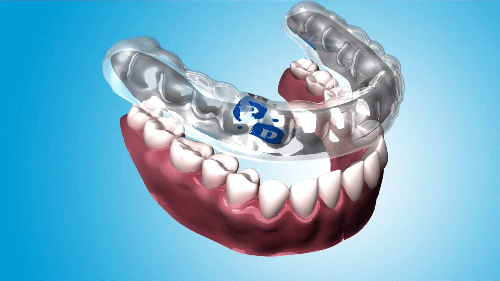 The Perio Protect Method The Non Invasive Way To Treat Periodontitis