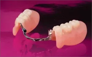 Partials | Stephens Dentistry
