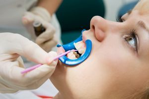 Dental Sealants | Stephens Dentistry