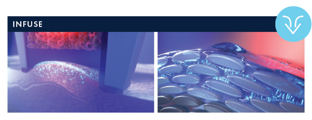 illustration demonstrating the infusion process of Obagi Skintrinsiq treatment