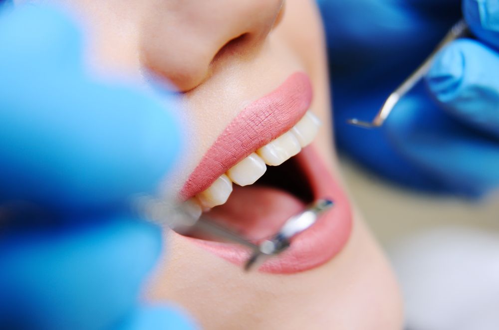 A woman is getting her teeth examined by a dentist.