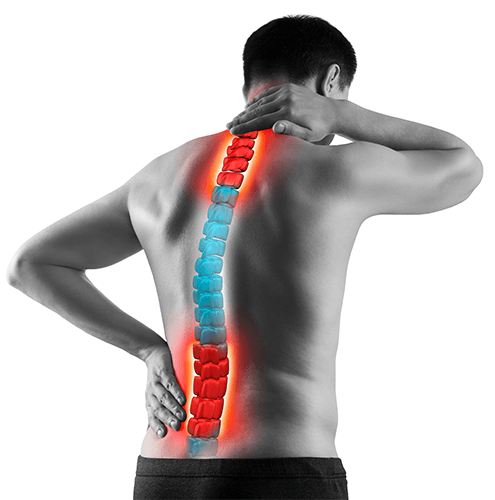 Man with back pain 
