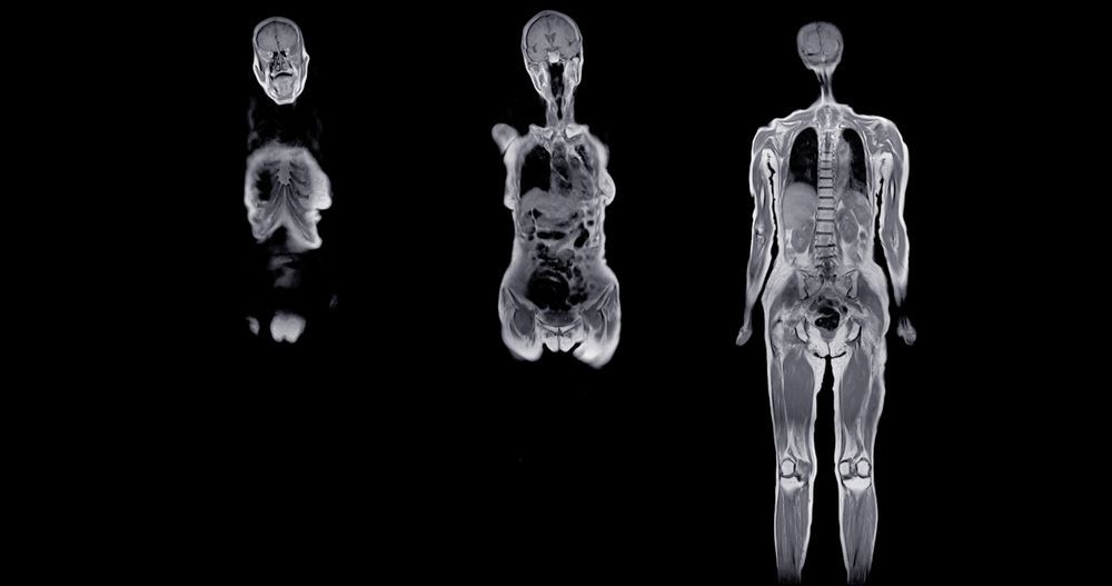 Three medical MRI scans of a human body, shown in varying degrees of detail against a black background.
