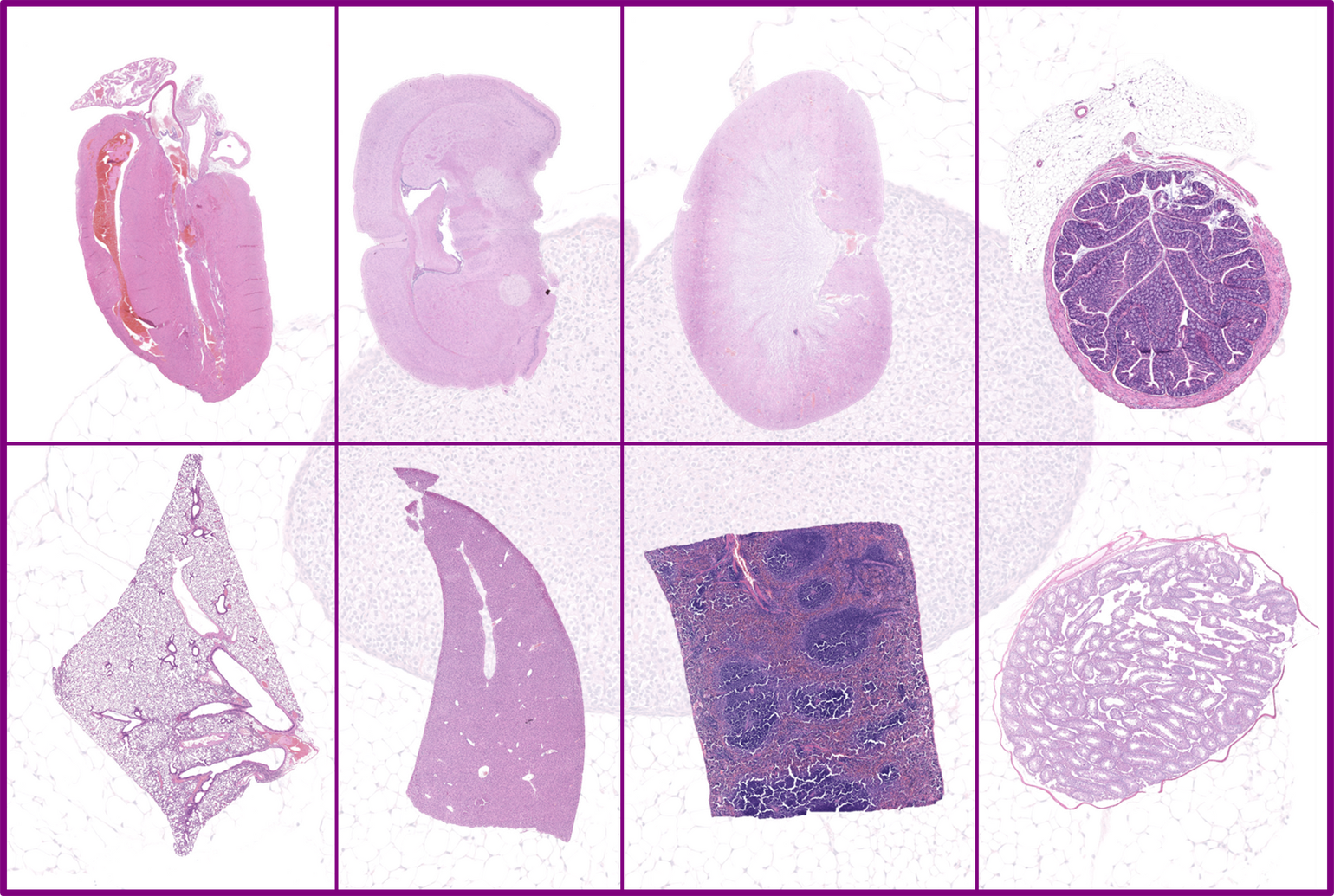 In Silico Drug Discovery GLP-1
