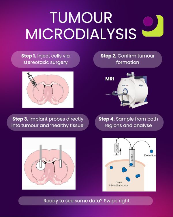 New Insights from Pharmidex: Tumour Microdialysis in Glioblastoma