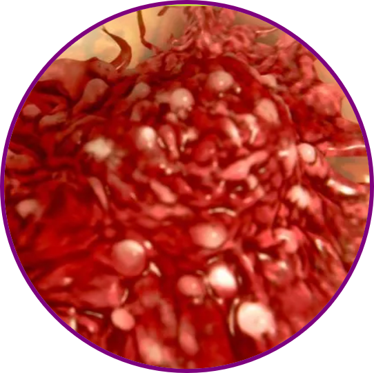 ONCOLOGY