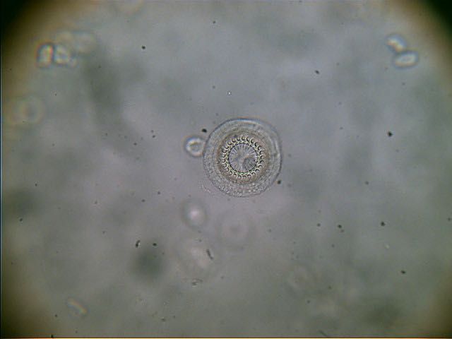 Eine Nahaufnahme eines kreisförmigen Objekts unter einem Mikroskop.