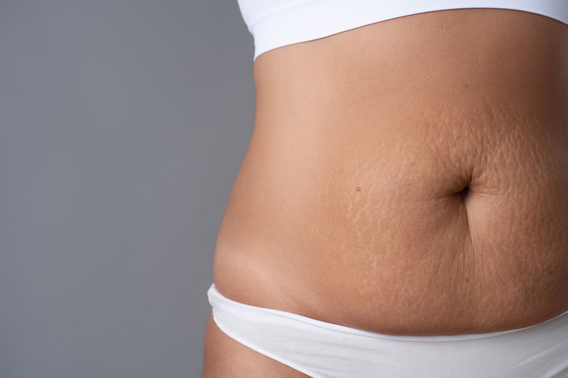 Skin — Vienna, VA — Body Sculpt Skin Laser