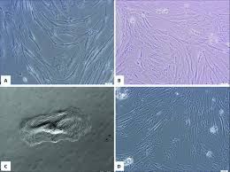 Microscopic views of cells in culture, labeled A, B, C, and D, with varied textures and shapes, possibly for scientific analysis.