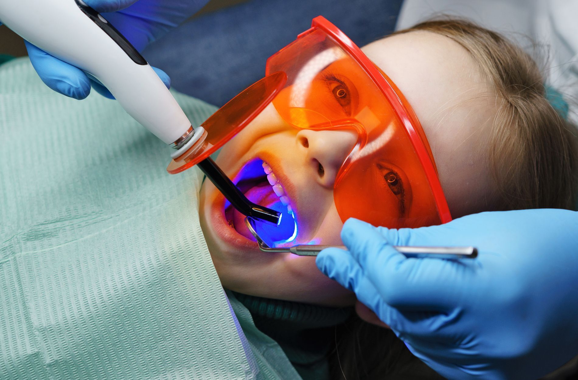 Types of Dental Fillings Materials and Advantages Explained