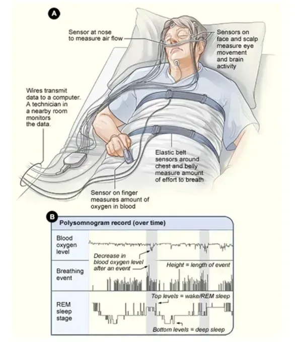 A diagram of a person laying in a hospital bed
