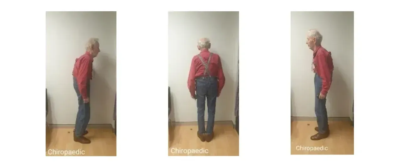 Images taken after treatment