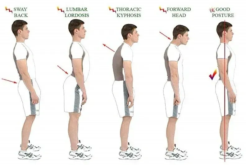 A drawing of a man 's posture showing different types of posture