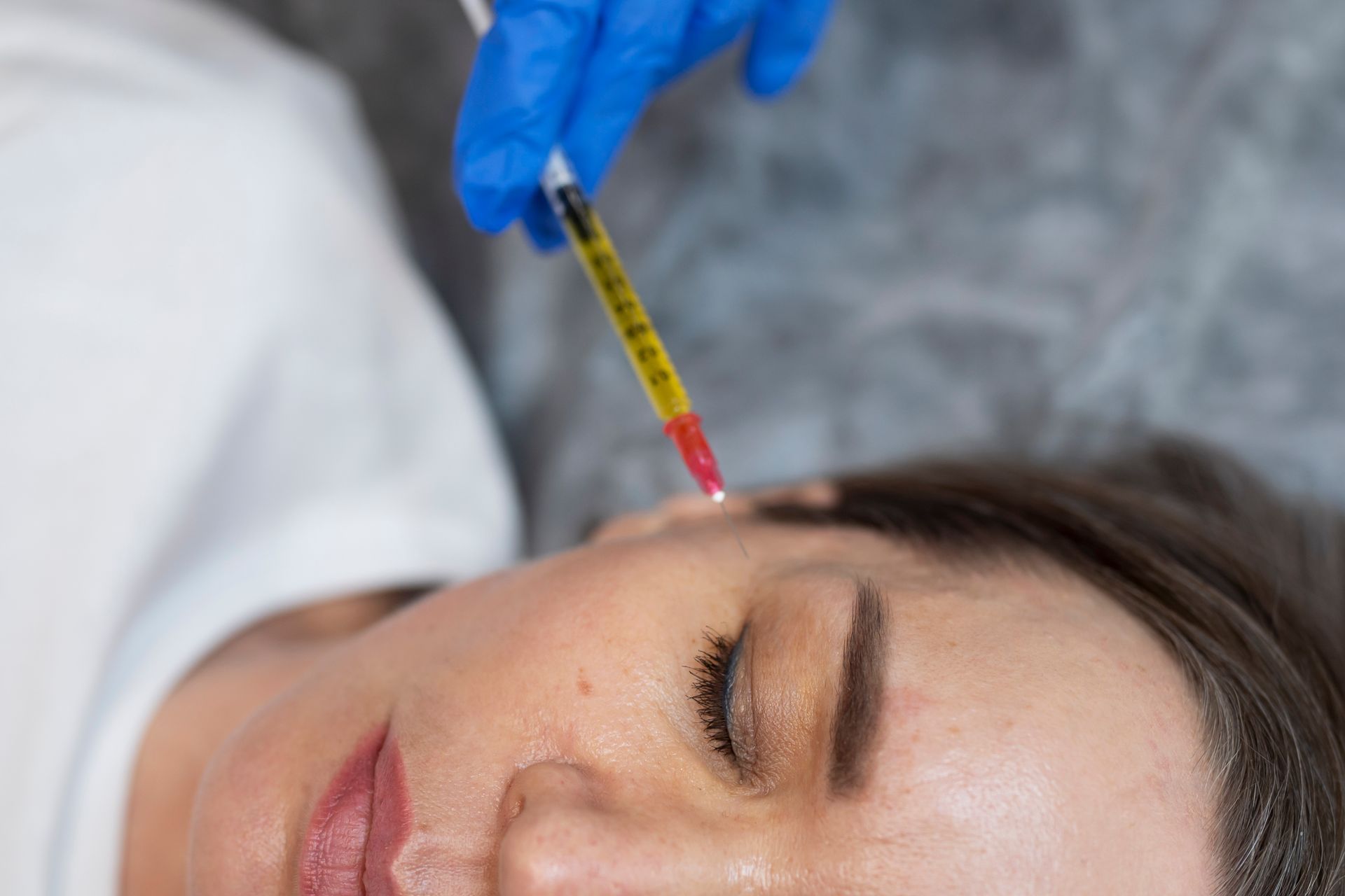 A woman is getting a botox injection in her forehead.