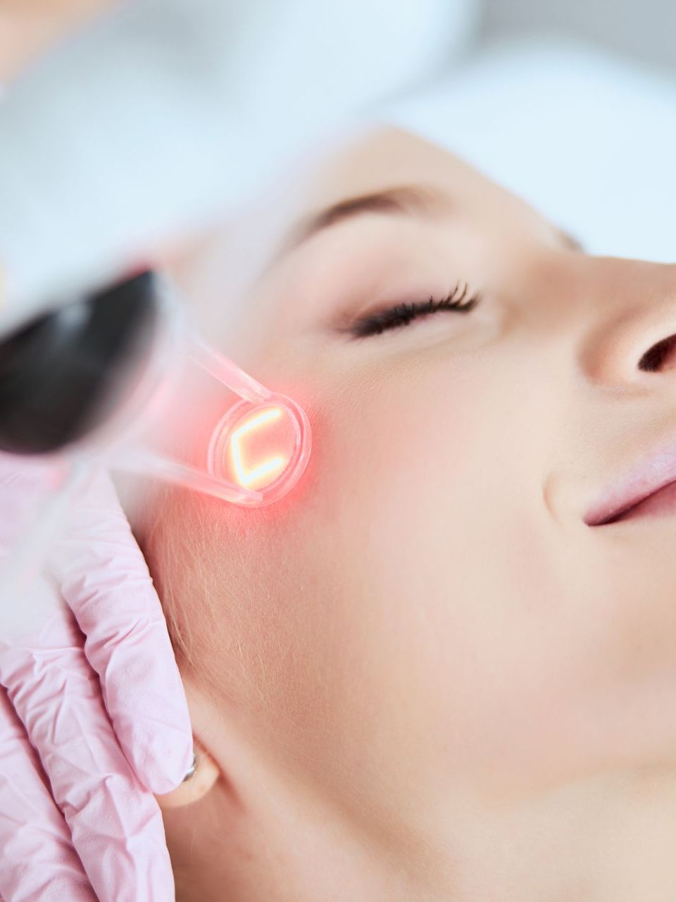 female getting red laser on face