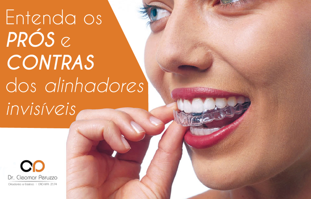 ALINHADOR ORTODÔNTICO E LENTE DE CONTATO DENTAL