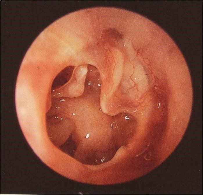 Intervento all'orecchio