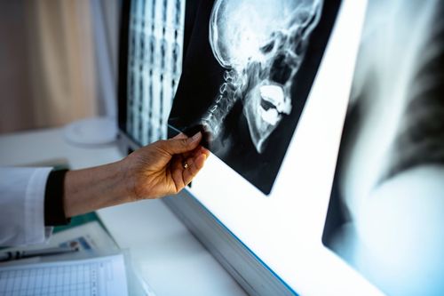 Radiografia del cranio
