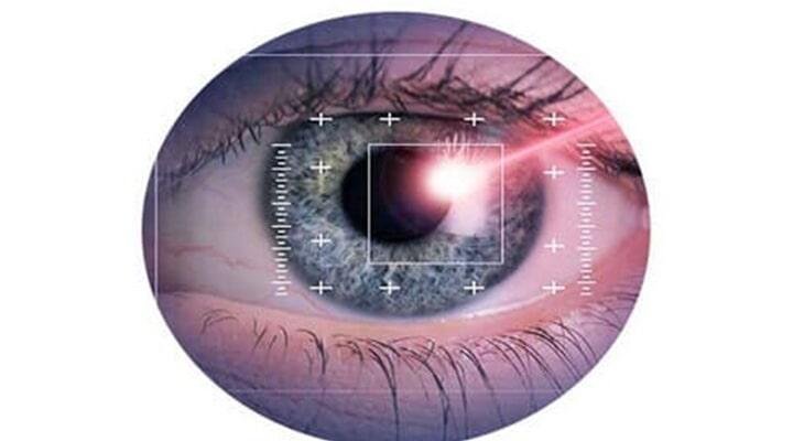 DRA. MÓNICA FLORES ACOSTA-Revisión ocular