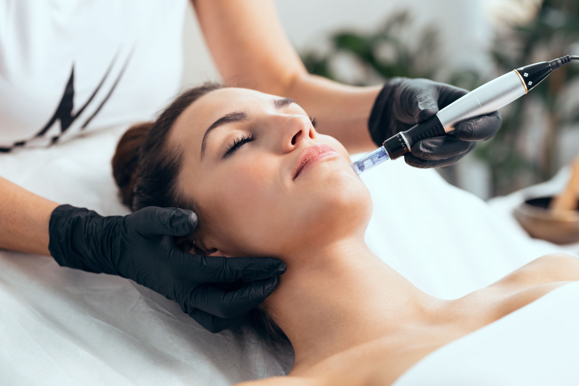 A woman is getting a microneedle treatment on her face.