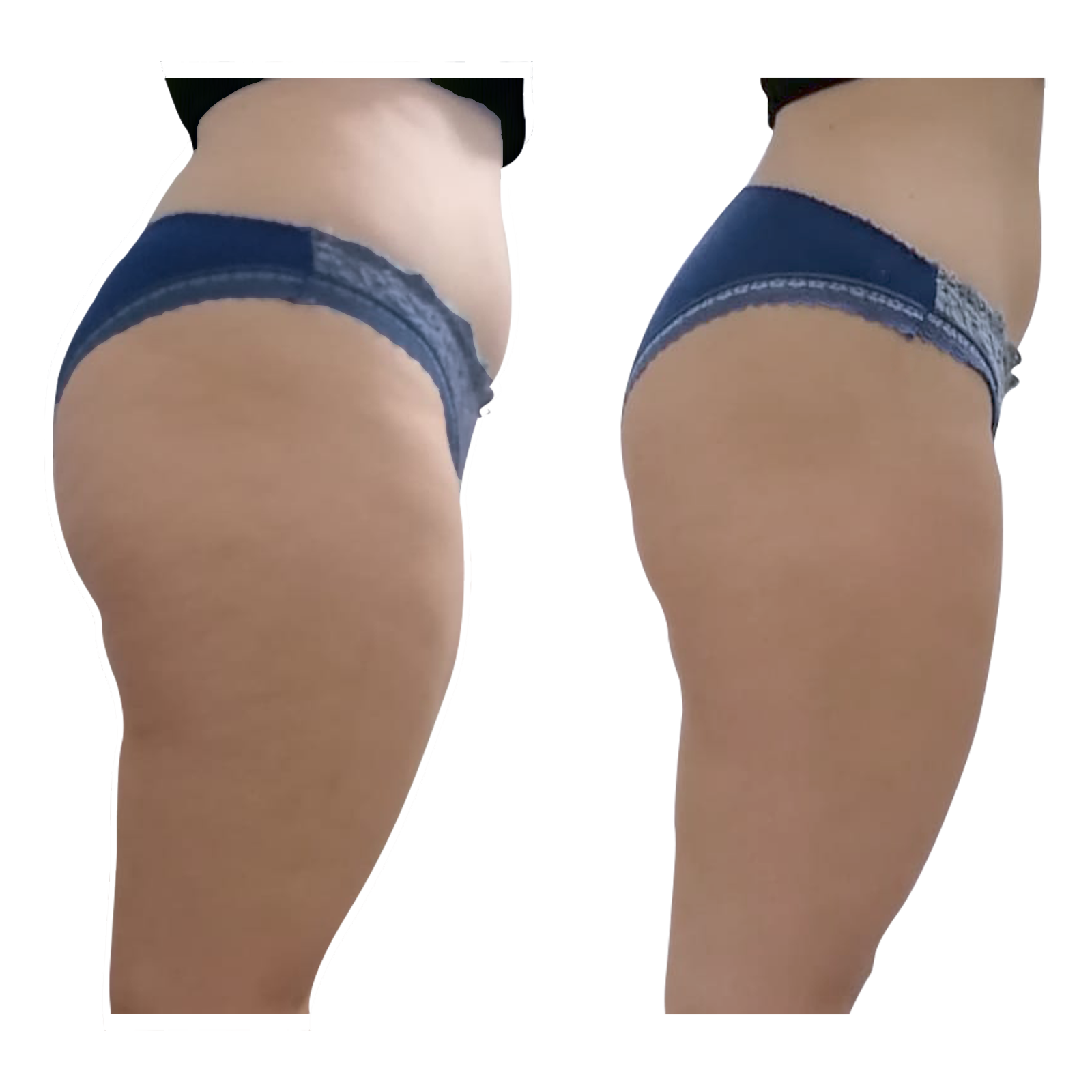 Two side views of a person's buttocks in underwear; before and after appearance comparison.