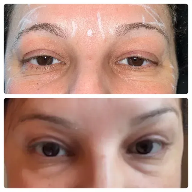 A before and after picture of a woman 's eyes.