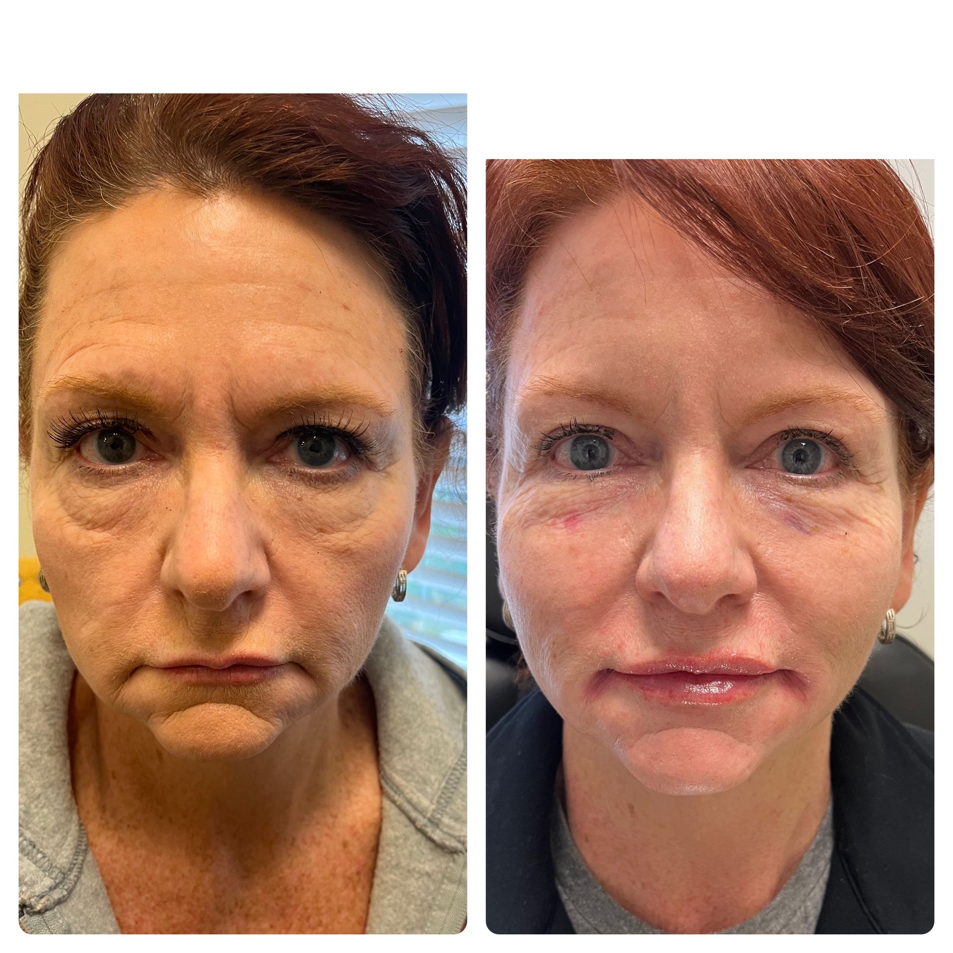 A before and after photo of a woman 's face.