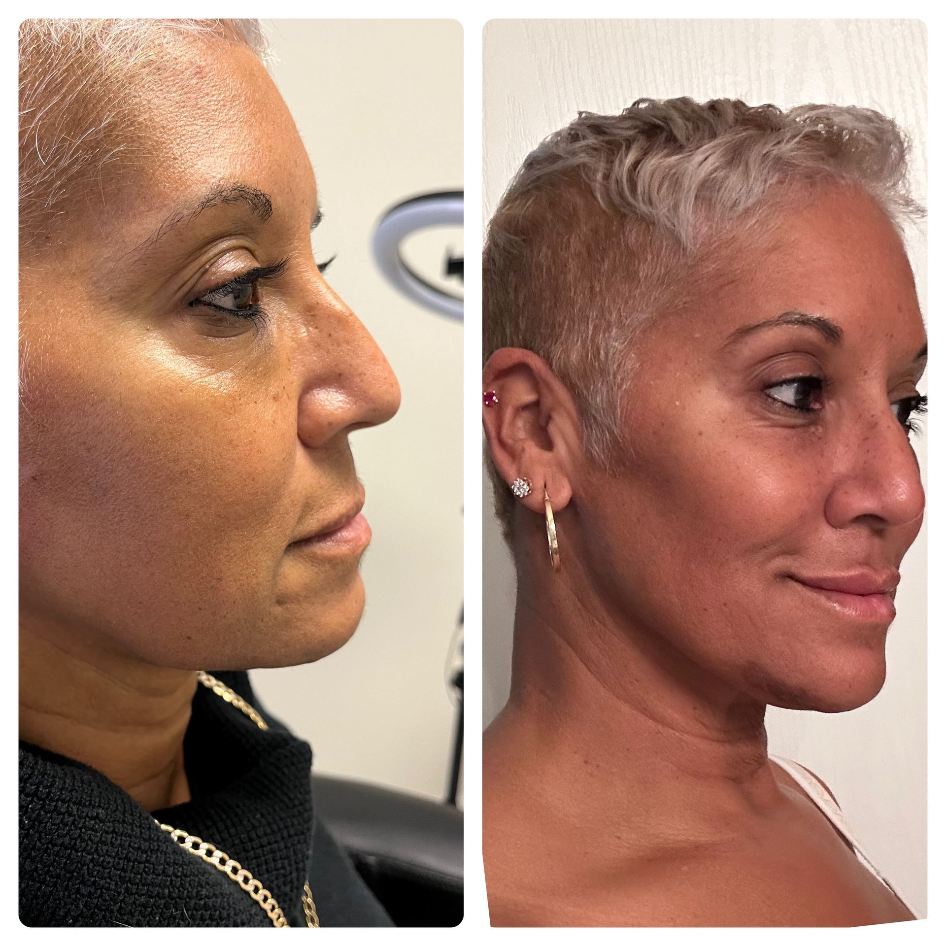 A before and after photo of a woman 's face.