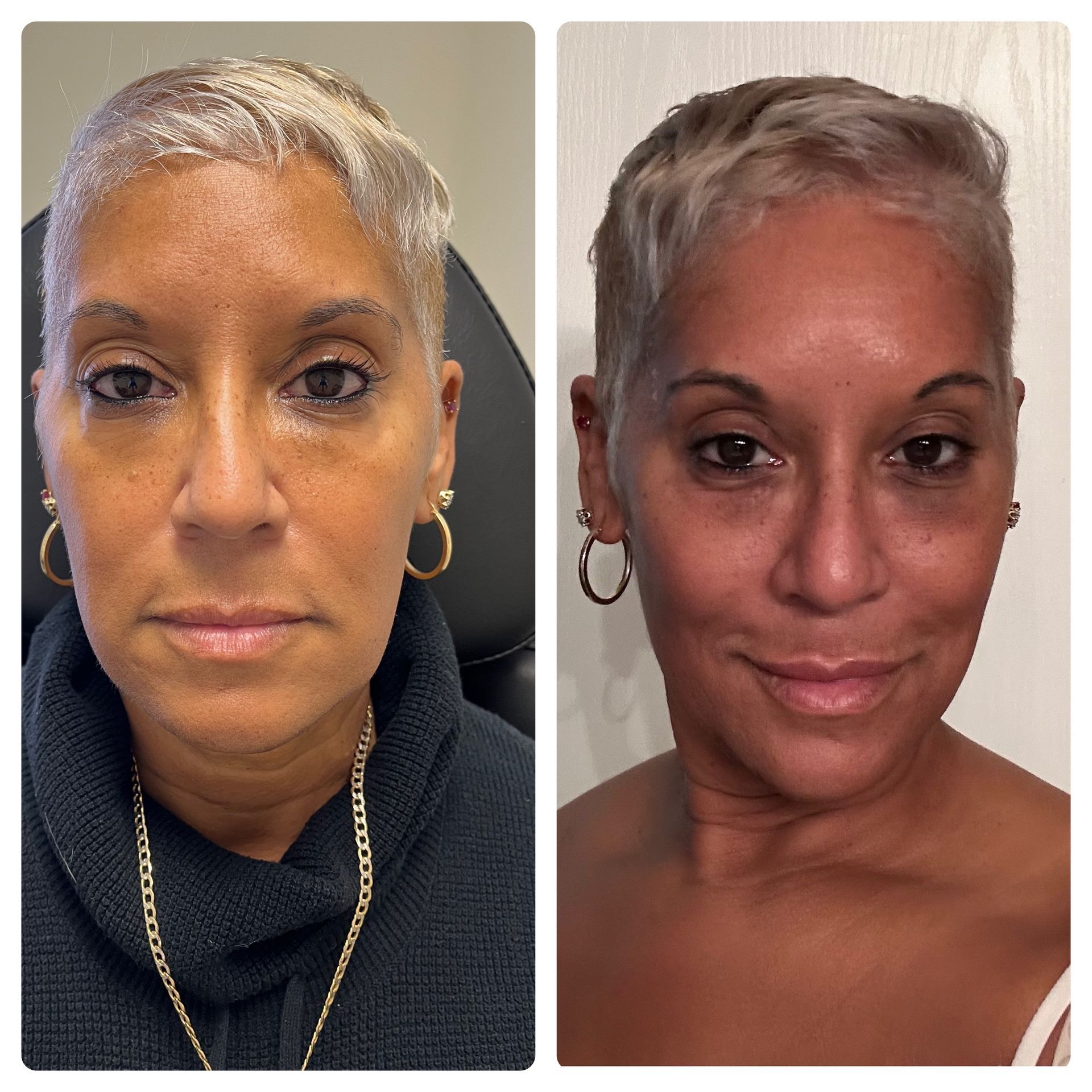 A before and after photo of a woman 's face.