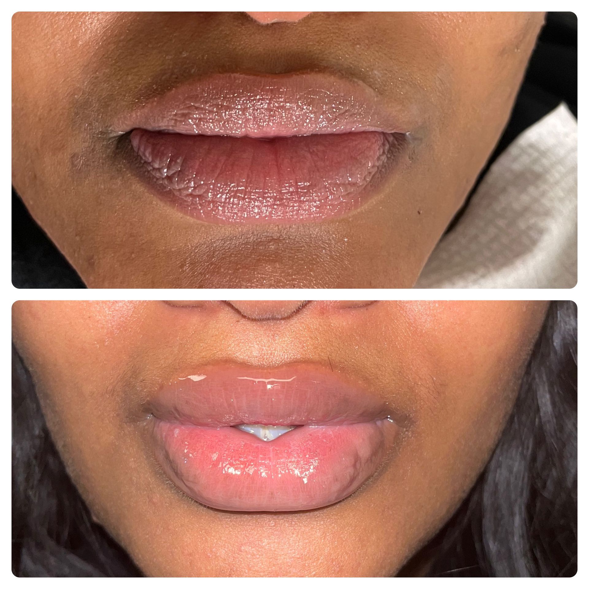 A before and after photo of a woman 's lips.