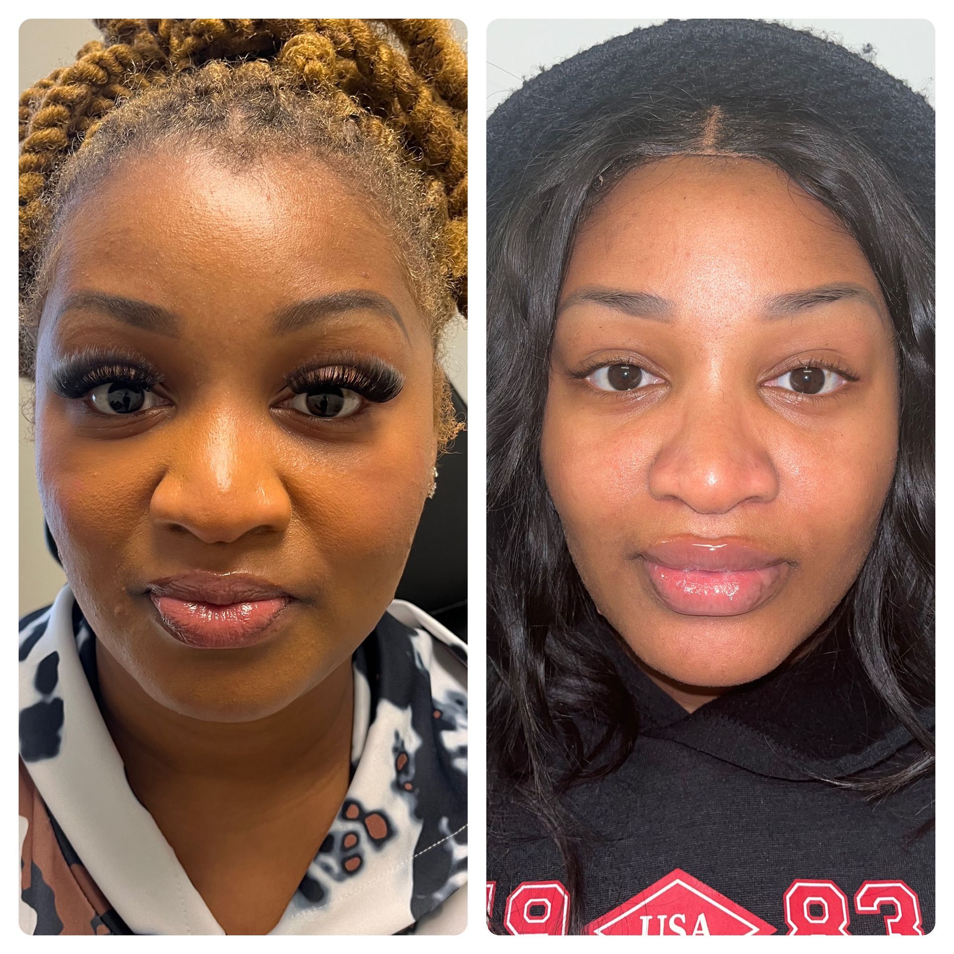 A before and after photo of a woman 's face.