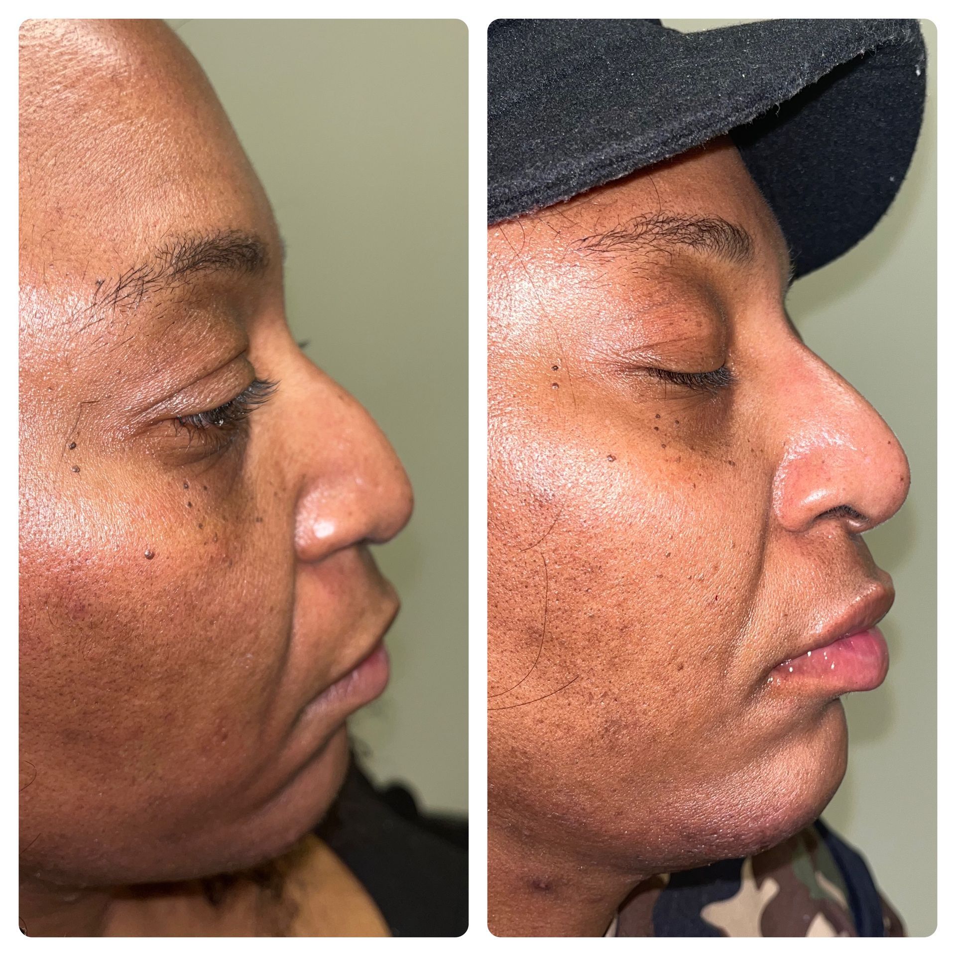 A before and after photo of a woman 's face