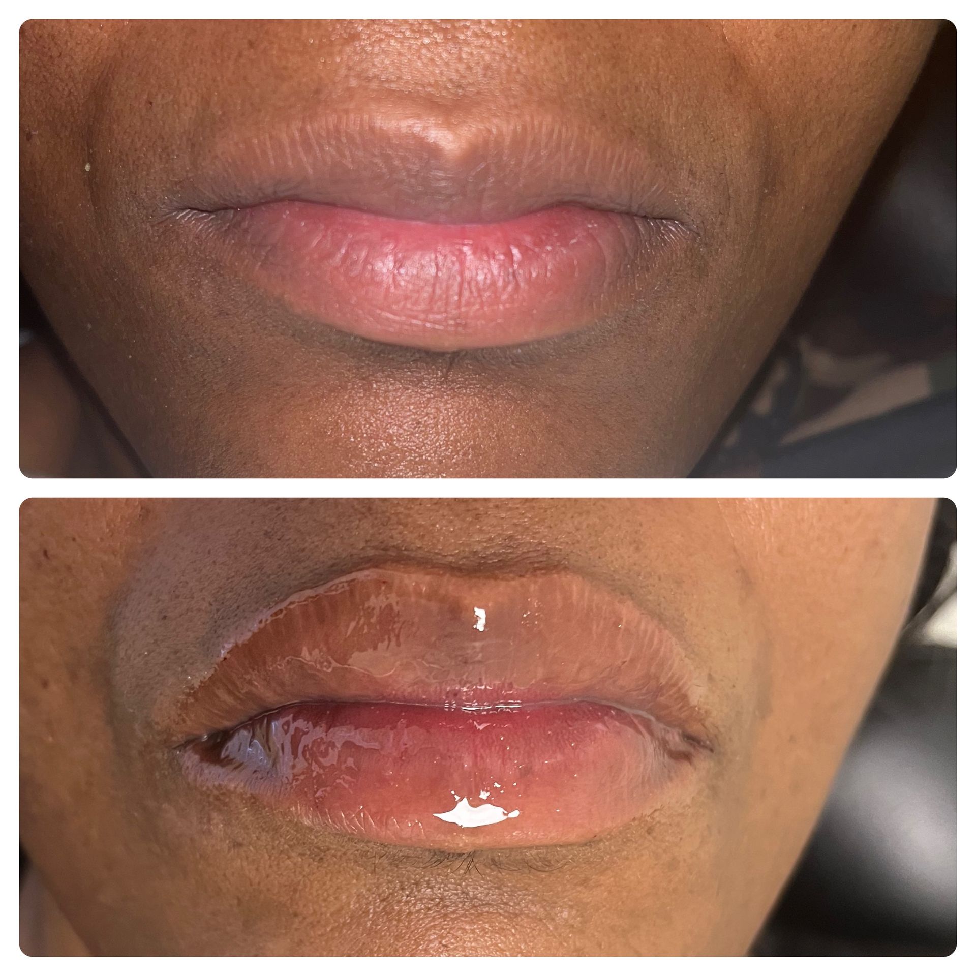 A before and after photo of a woman 's lips.